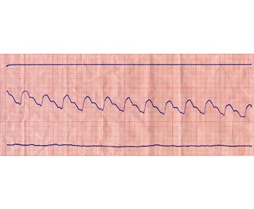 Terzo Medio (Tracciato Reografico)