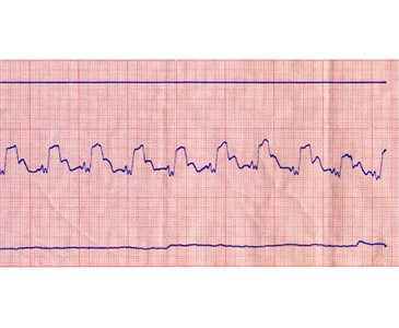 Terzo Superiore (Tracciato Reografico)