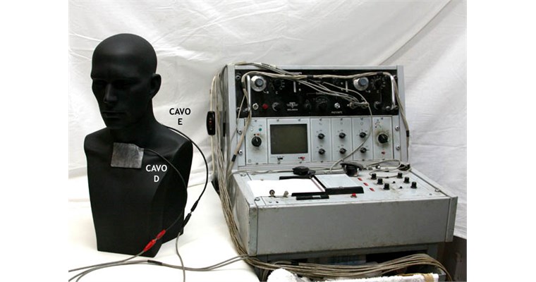 Piastra (Più piccola A) Terzo superiore a livello della seconda articolazione sterno-costale  