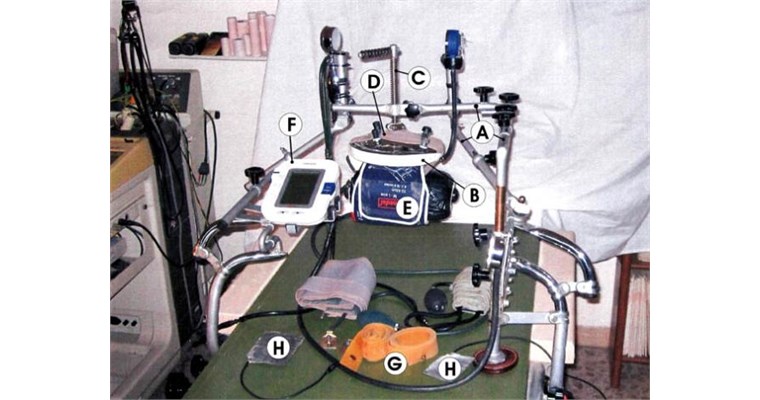 Avveniristico aortotest G.K. addominale